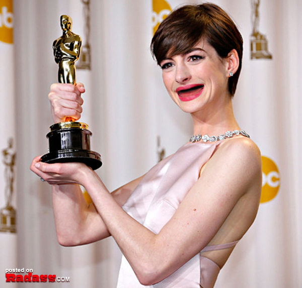 Anne Hathaway holding an Oscar, toothless celebrities.