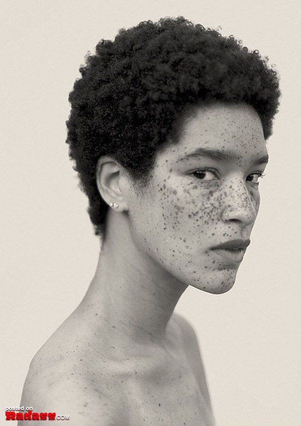 A unique black woman with freckles on her face.